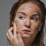 Як позбутися чорних цяток на носі: методи, які можна використовувати вдома