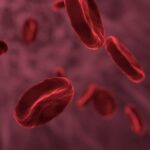 Названо прості способи зменшення холестеринових бляшок