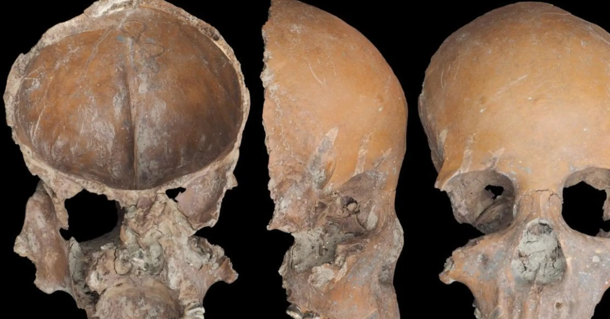 Археологи виявили 5000-річні чаші з людських кісток у Китаї 2 У Китаї виявили чаші з черепів людей віком 5000 років (фото)